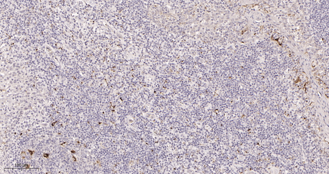 Rabbit Monoclonal Antibody to FAK