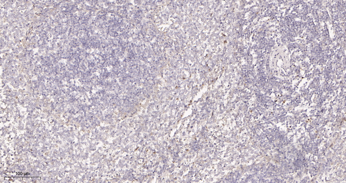 Rabbit Monoclonal Antibody to FAK