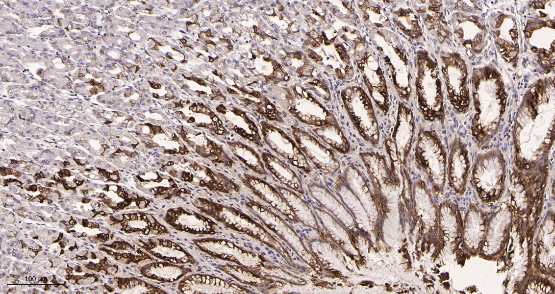 Rabbit Monoclonal Antibody to Mucin 5AC