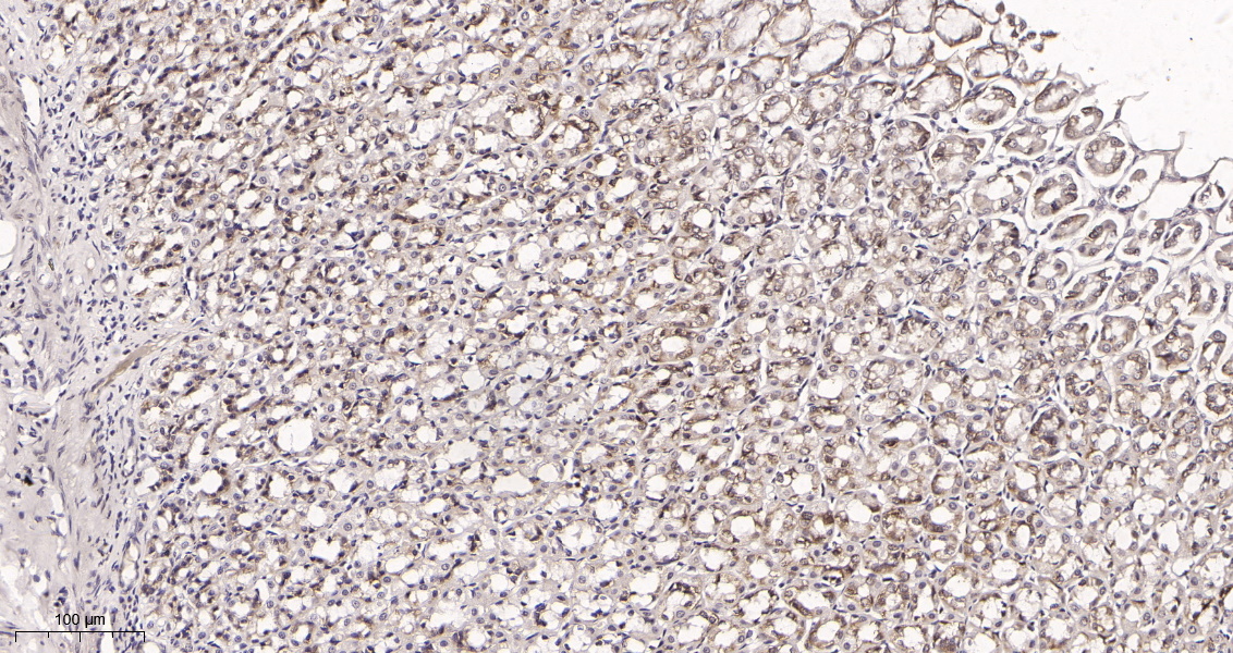 Rabbit Monoclonal Antibody to Mucin 5AC