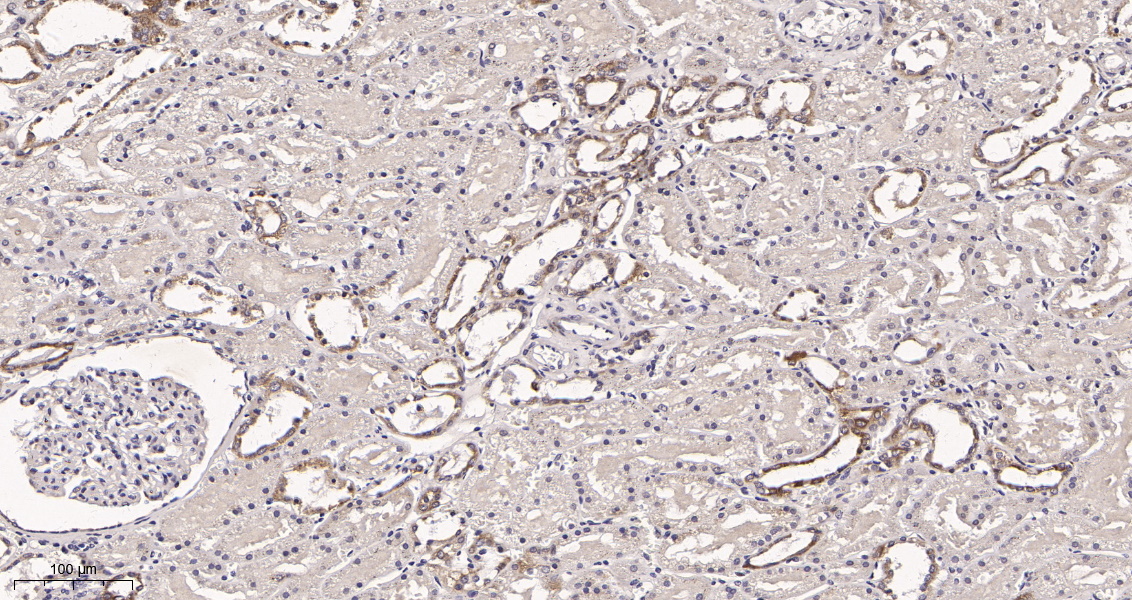 Rabbit Monoclonal Antibody to SIRT3