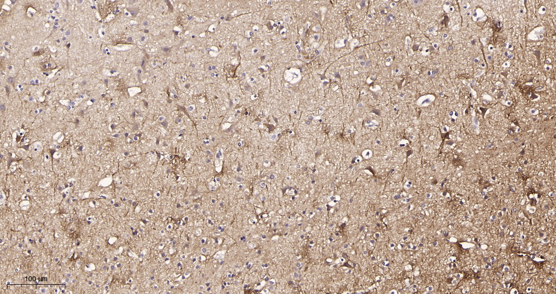 Rabbit Monoclonal Antibody to Neurofilament heavy polypeptide