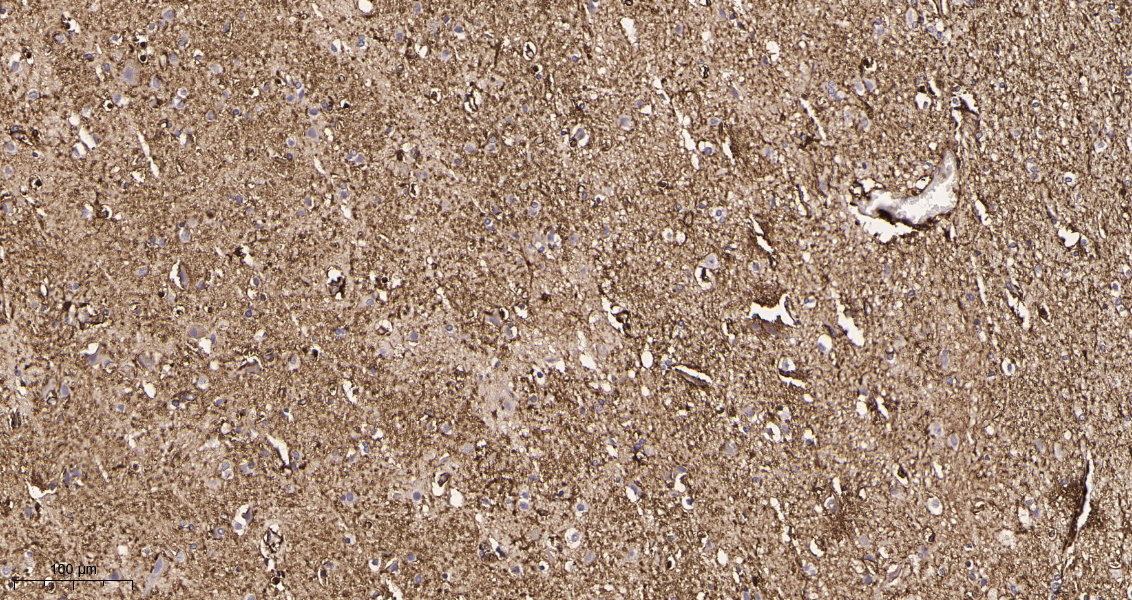 Rabbit Monoclonal Antibody to GFAP