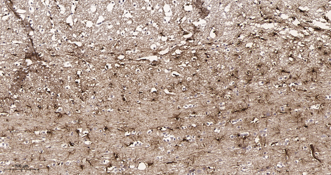 Rabbit Monoclonal Antibody to GFAP