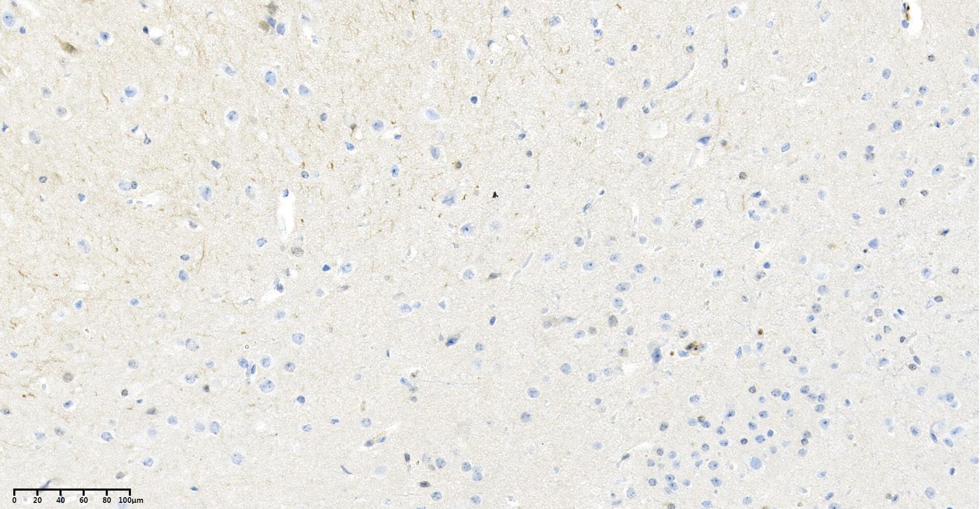 Rabbit Monoclonal Antibody to Hsp70