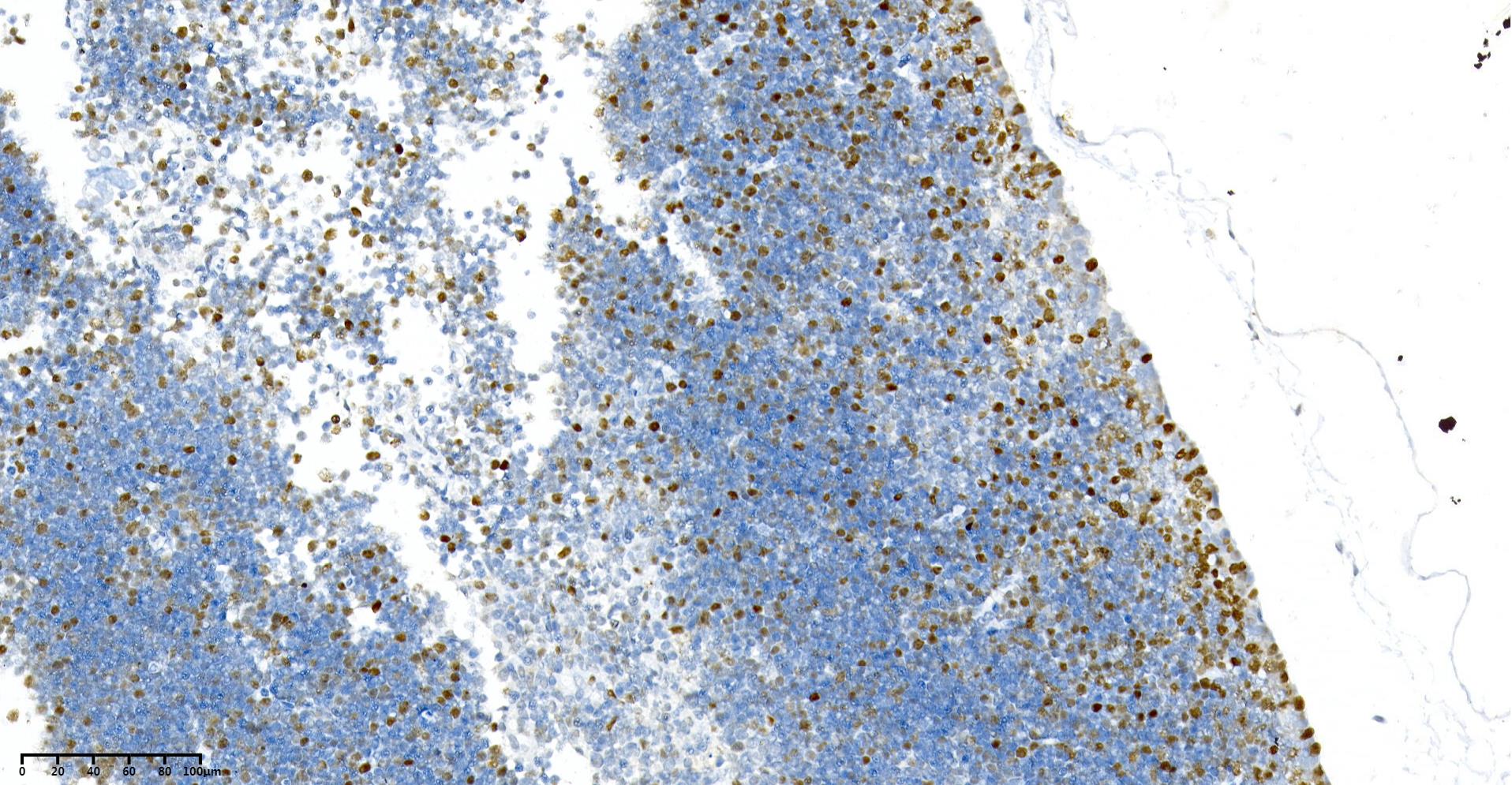 Rabbit Monoclonal Antibody to PCNA