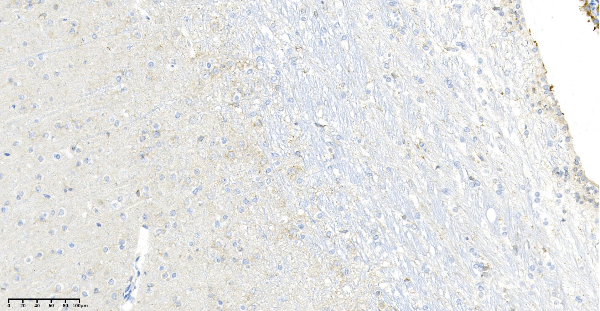 Rabbit Monoclonal Antibody to LRP1