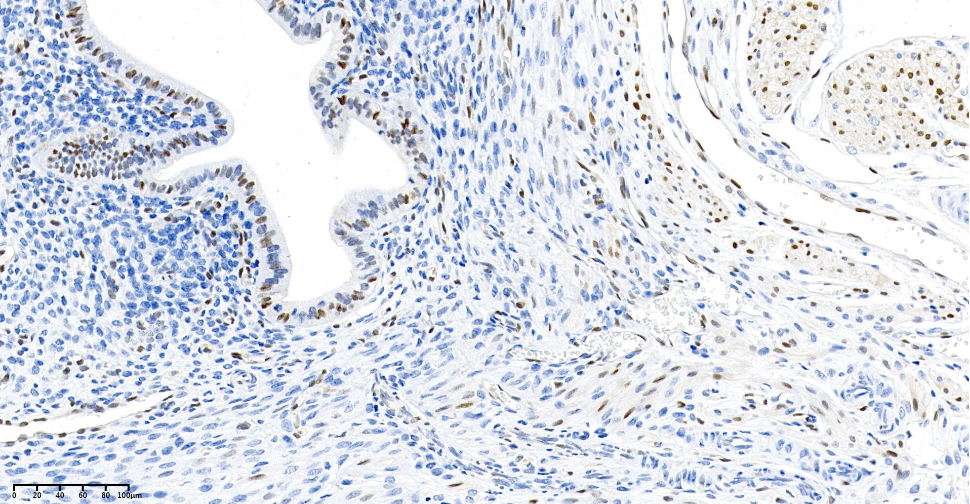 Rabbit Monoclonal Antibody to Cyclin D1