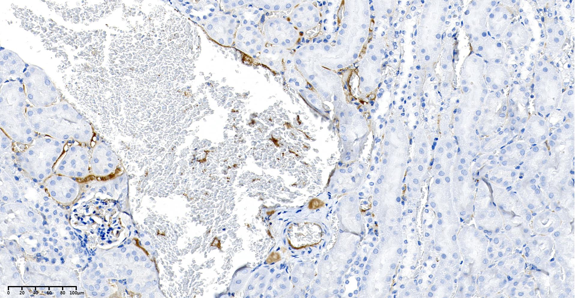 Rabbit Monoclonal Antibody to LAMP2