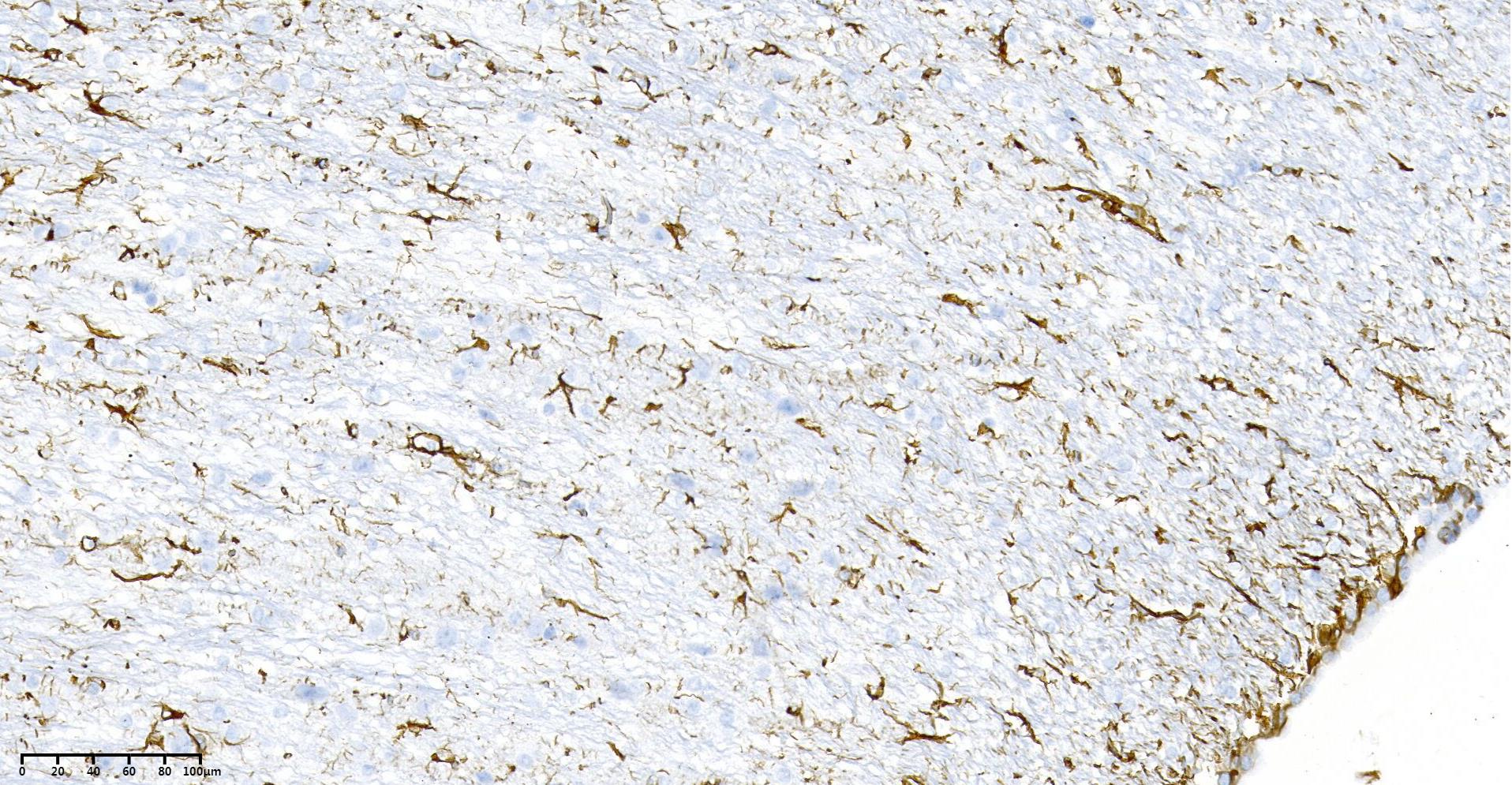 Rabbit Monoclonal Antibody to GFAP