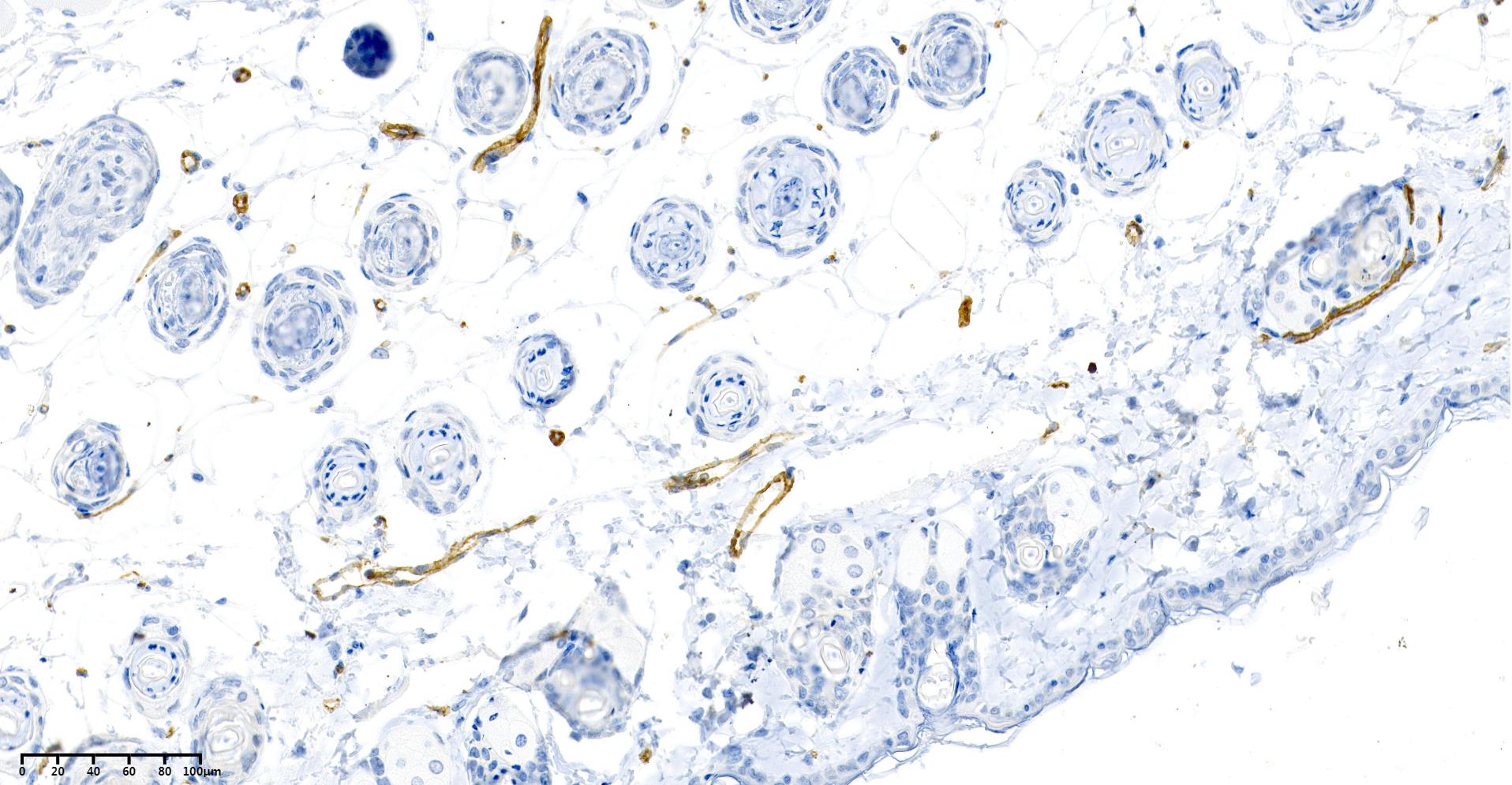 Rabbit Monoclonal Antibody to CD31
