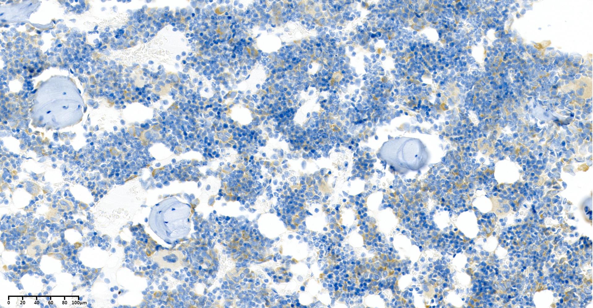 Rabbit Monoclonal Antibody to BMP2