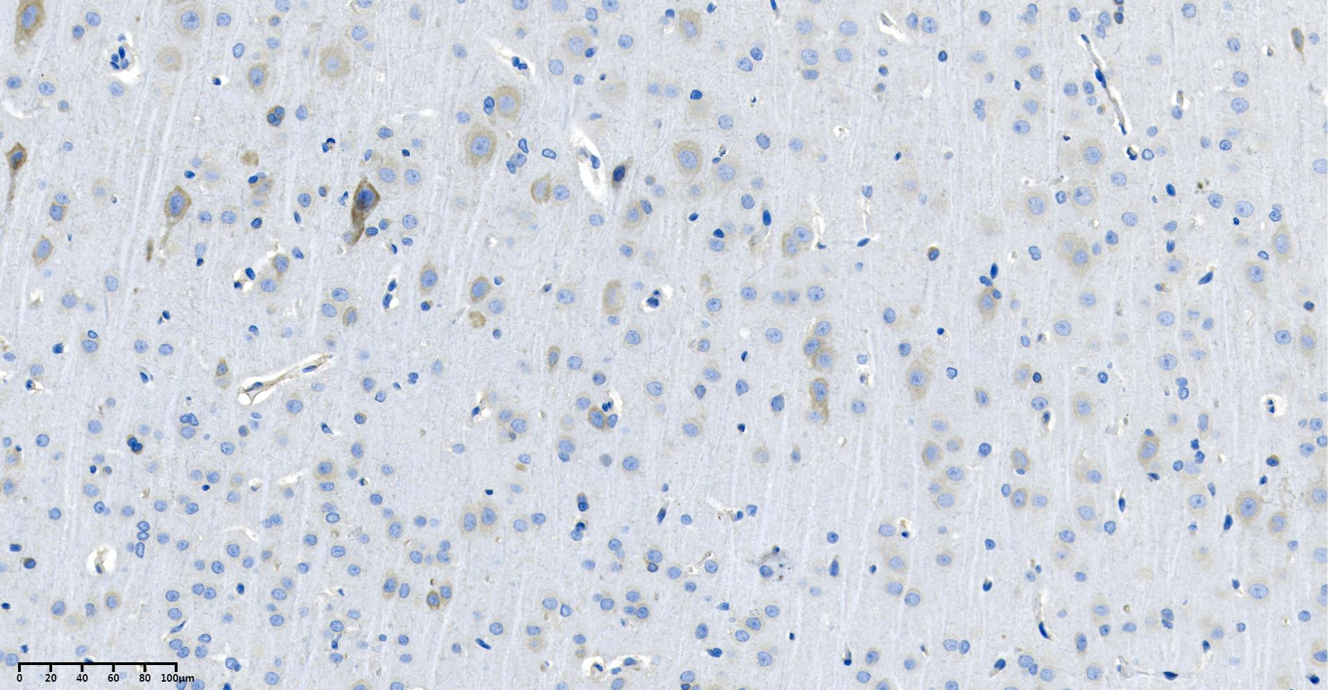 Rabbit Monoclonal Antibody to Arginase-1