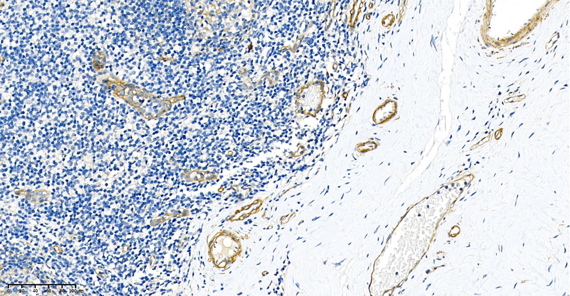 Rabbit Monoclonal Antibody to CD146