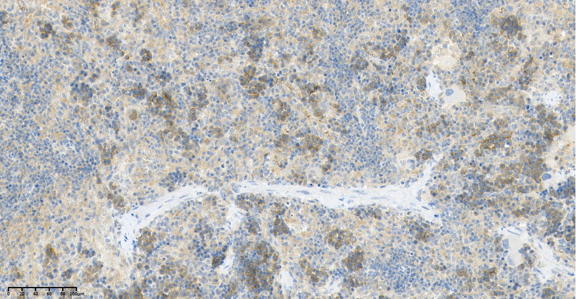Rabbit Monoclonal Antibody to TBK1