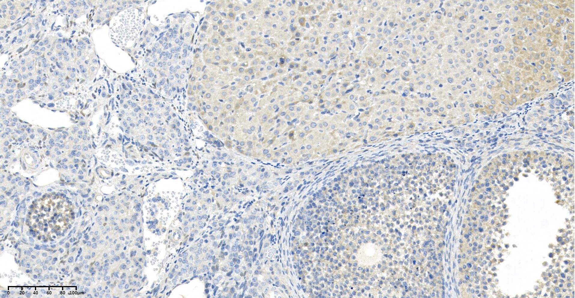 Rabbit Monoclonal Antibody to mTOR (Phospho Ser2448)