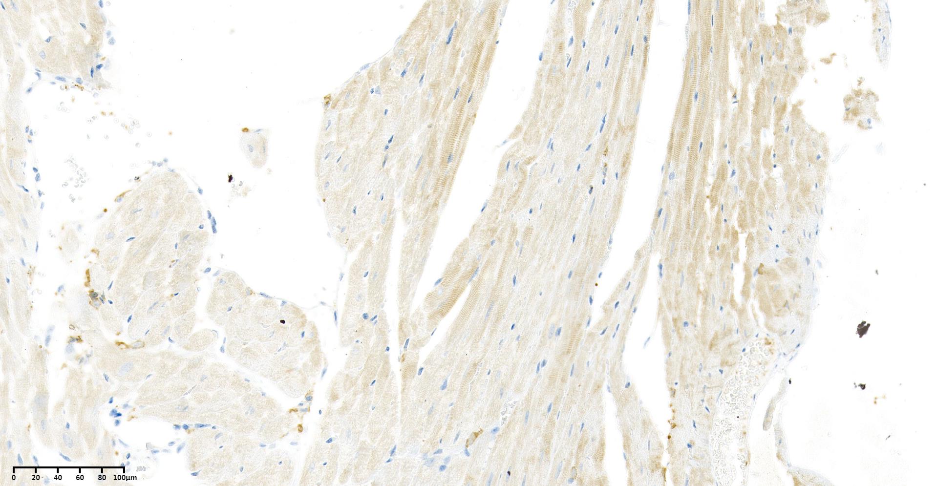 Rabbit Monoclonal Antibody to VEGFA