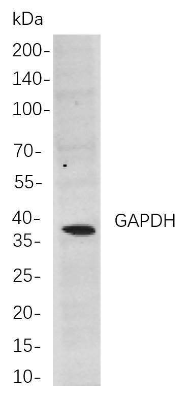 GAPDH