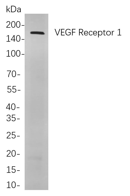VEGF Receptor 1