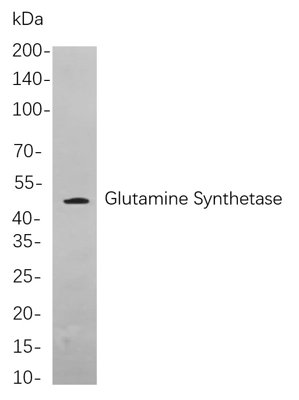 Glutamine Synthetase