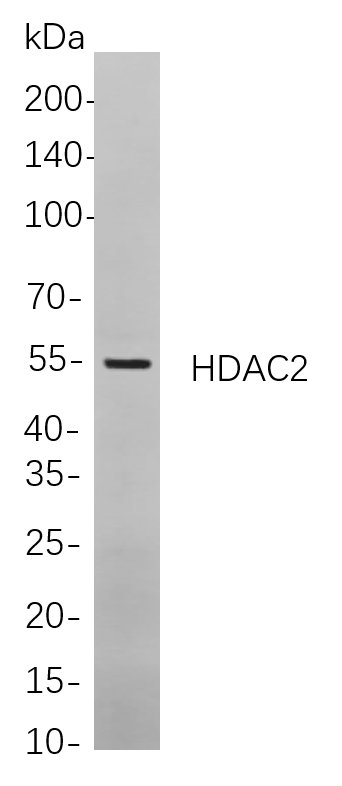 HDAC2