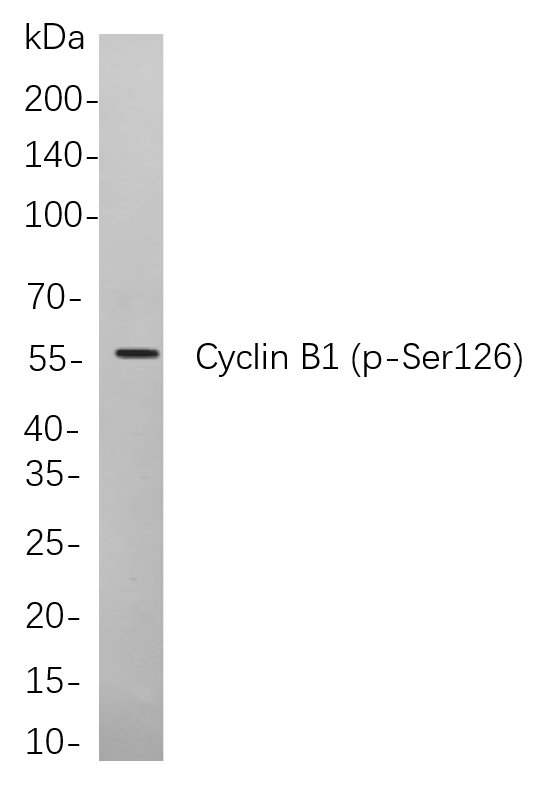 Cyclin B1 (Phospho Ser126)