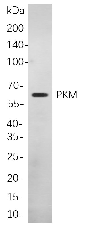 PKM