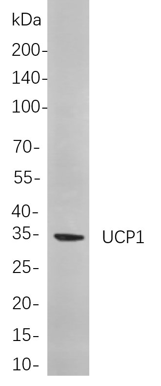UCP1