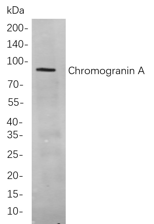 Chromogranin A