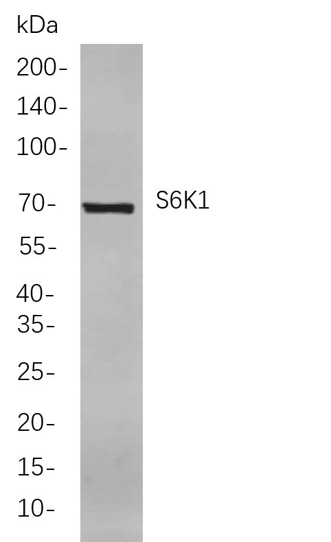 S6K1