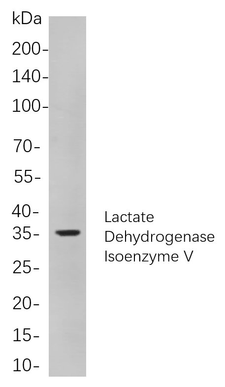 Lactate Dehydrogenase Isoenzyme V