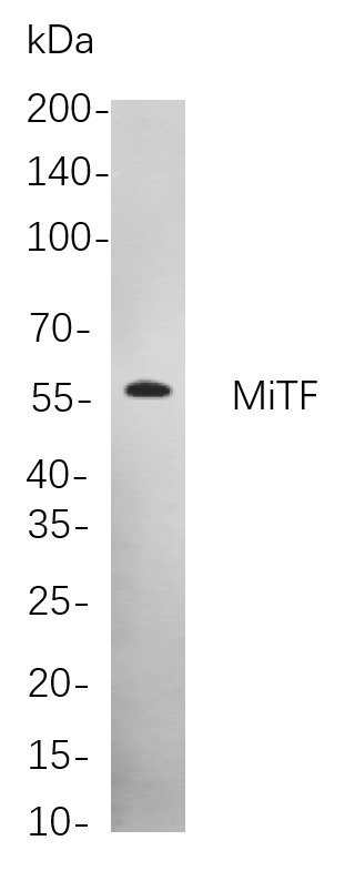MiTF