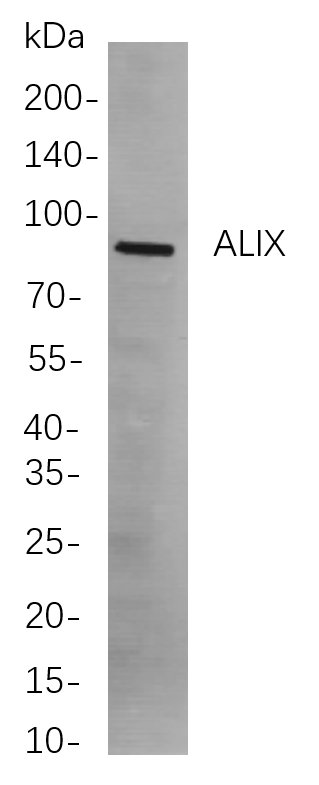 ALIX