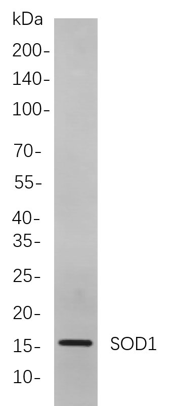 SOD1
