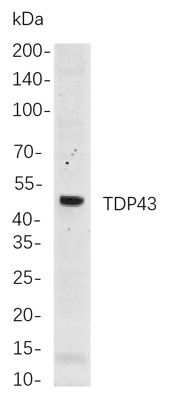 TDP43