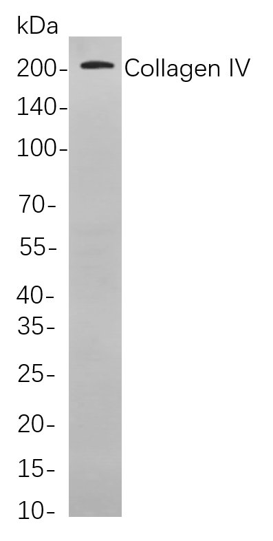 Collagen IV