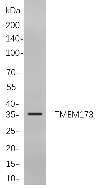TMEM173