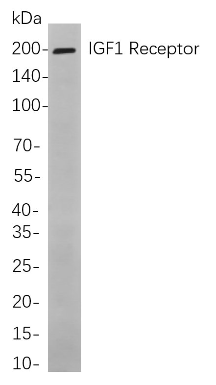 IGF1 Receptor