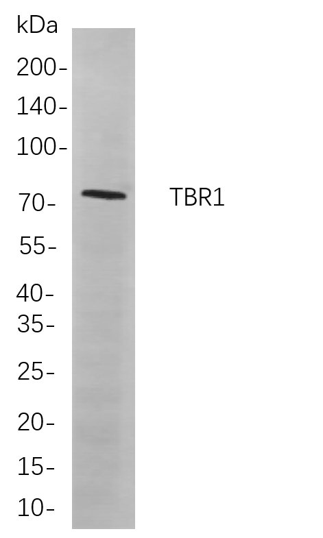 TBR1