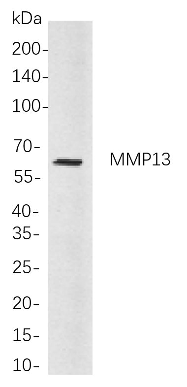 MMP13