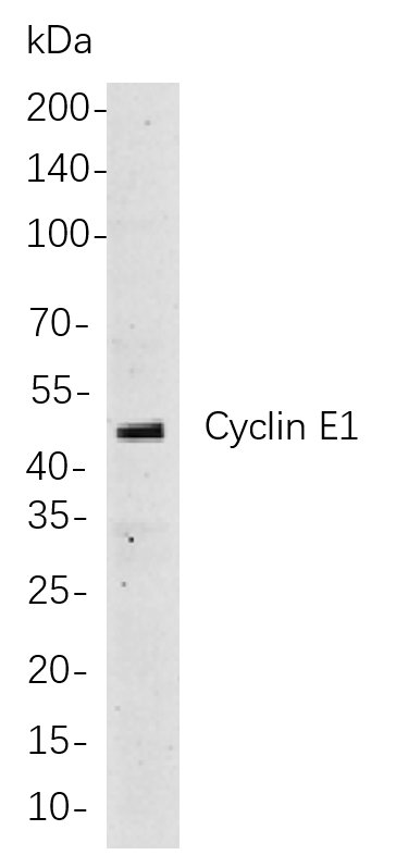 Cyclin E1