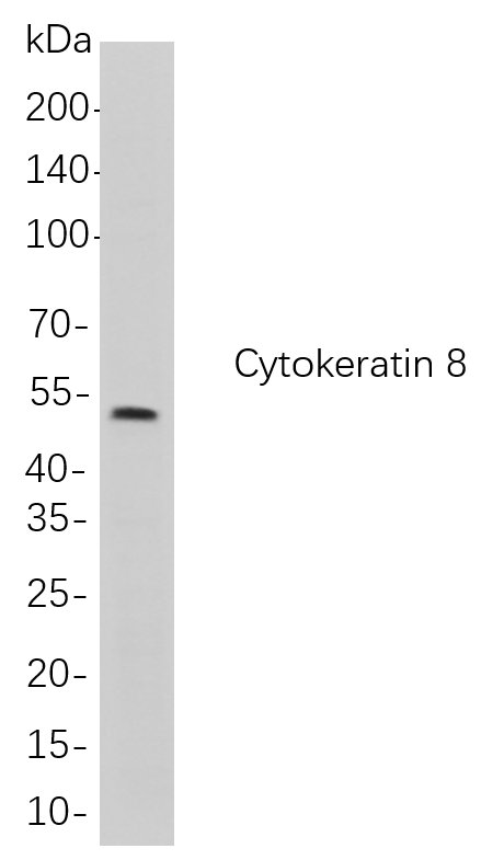 Cytokeratin 8