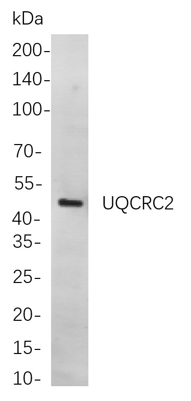 UQCRC2