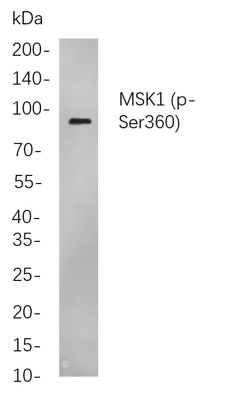 MSK1 (Phospho Ser360)