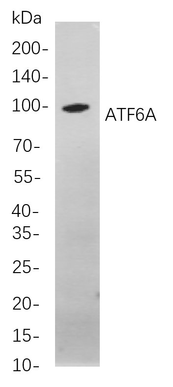 ATF6A
