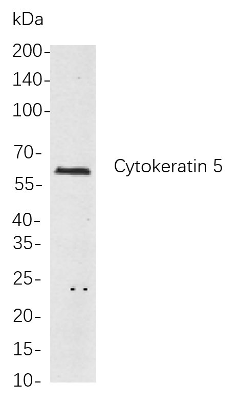 Cytokeratin 5