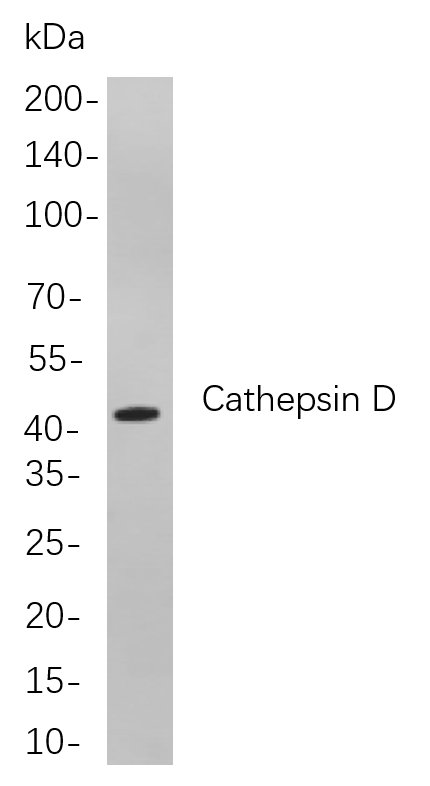 Cathepsin D