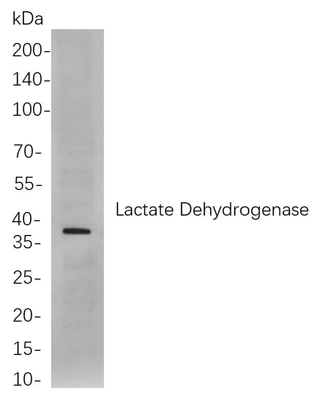 Lactate Dehydrogenase