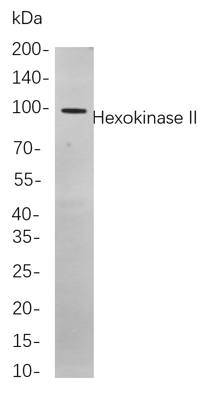 Hexokinase II