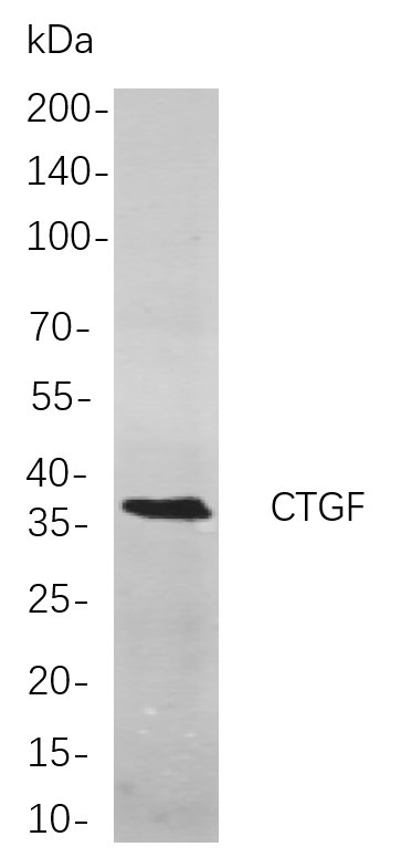 CTGF